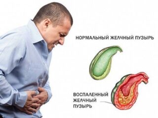 Холец